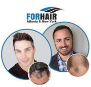 FORHAIR Hair Transplant Clinic